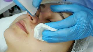 Curatare cu ultrasunete a fetei Curatare cu ultrasunete a fetei
