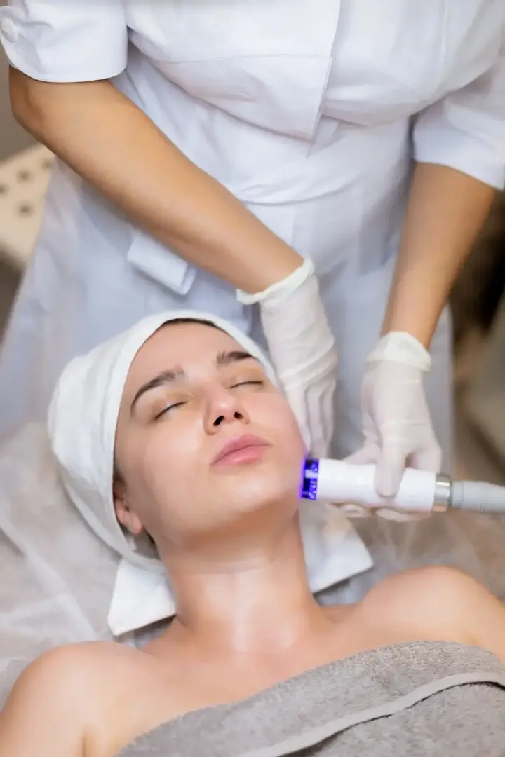 Microneedling Bacau – imagine ilustrativa a unei proceduri faciale cu aplicator cosmetic