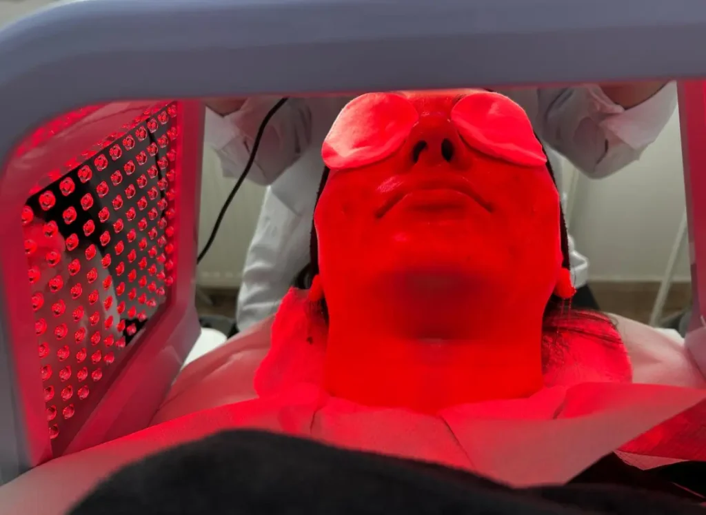 Workshop tratamente faciale în Bacău la MarabuCenter – fototerapie