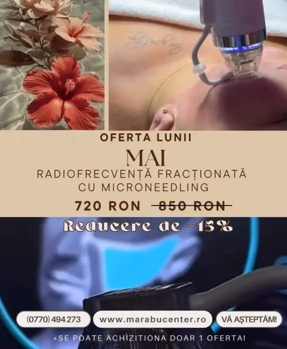 Oferta radiofrecvență fracționată cu microneedling în Bacău – reducere 15% la MarabuCenter