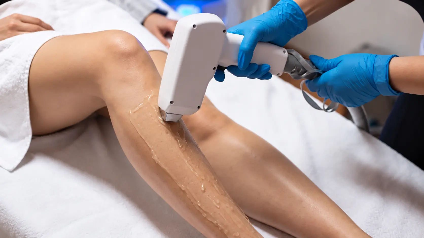 Epilarea laser după bronz în Bacău Procedură de epilare laser la Marabu Center Bacău